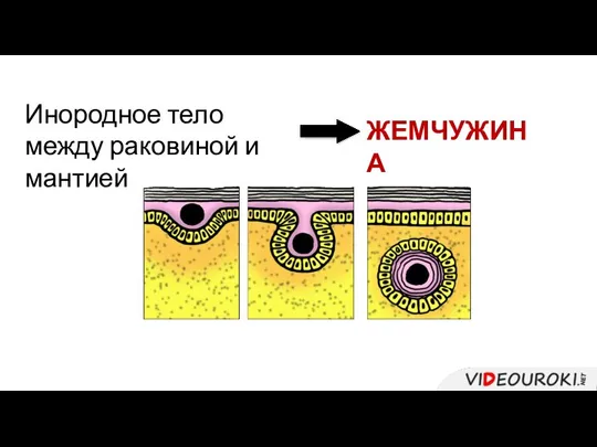 Инородное тело между раковиной и мантией ЖЕМЧУЖИНА