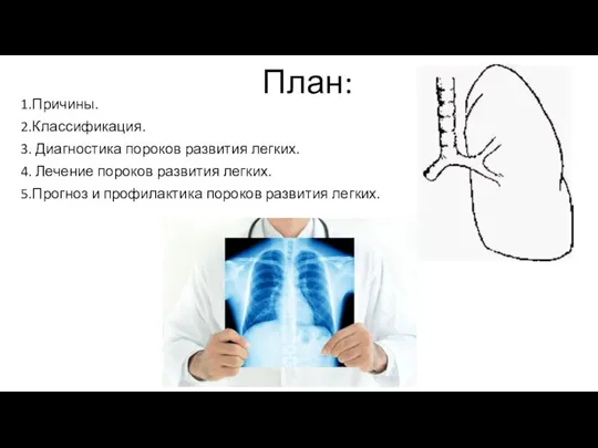 План: 1.Причины. 2.Классификация. 3. Диагностика пороков развития легких. 4. Лечение пороков развития