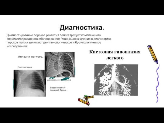 Диагностика. Диагностирование пороков развития легких требует комплексного специализированного обследования! Решающее значение в