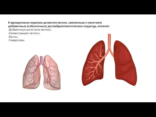 К врожденным порокам развития легких, связанным с наличием добавочных (избыточных) дизэмбриогенетических структур,