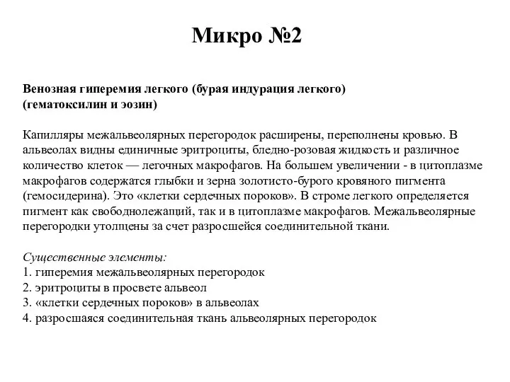 Микро №2 Венозная гиперемия легкого (бурая индурация легкого) (гематоксилин и эозин) Капилляры