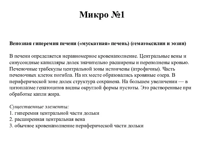 Микро №1 Венозная гиперемия печени («мускатная» печень) (гематоксилин и эозин) В печени