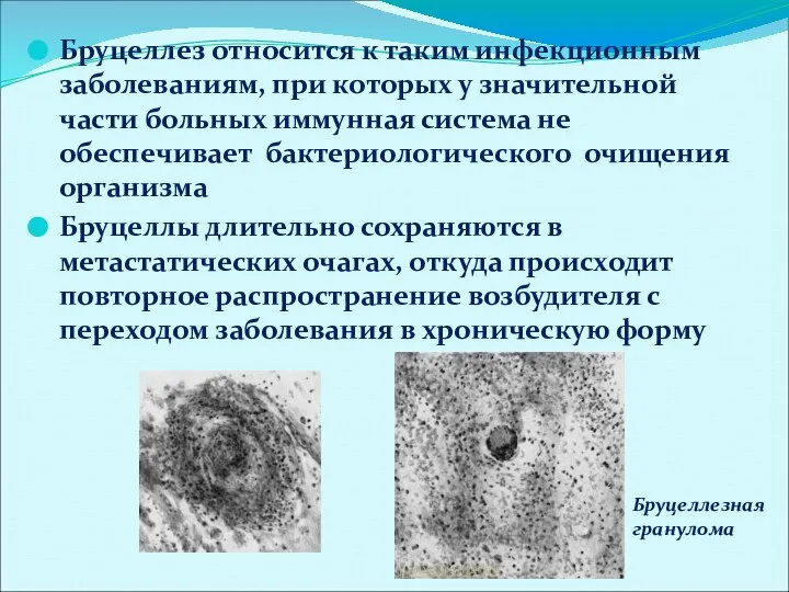 Бруцеллез относится к таким инфекционным заболеваниям, при которых у значительной части больных