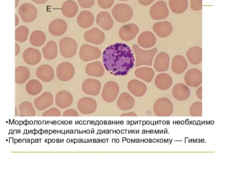 Морфологическое исследование эритроцитов необходимо для дифференциальной диагностики анемий. Препарат крови окрашивают по Романовскому — Гимзе.