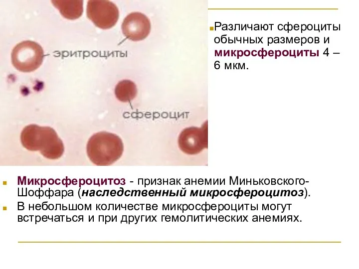 Микросфероцитоз - признак анемии Миньковского-Шоффара (наследственный микросфероцитоз). В небольшом количестве микросфероциты могут