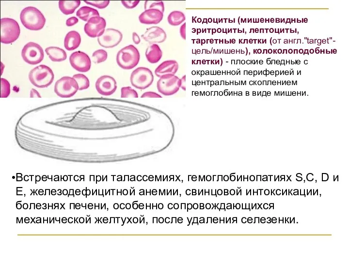 Кодоциты (мишеневидные эритроциты, лептоциты, таргетные клетки (от англ."target"-цель/мишень), колоколоподобные клетки) - плоские