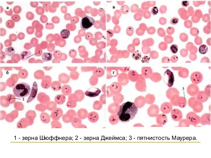 1 - зерна Шюффнера; 2 - зерна Джеймса; 3 - пятнистость Маурера.