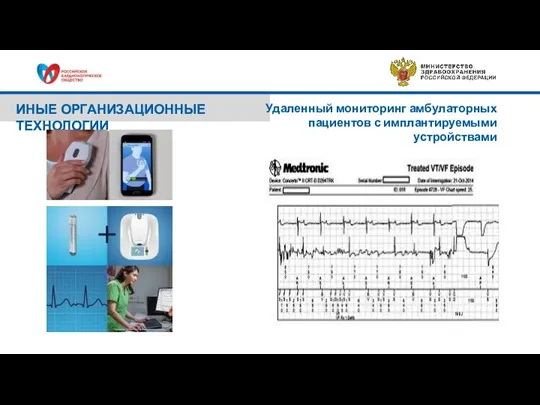 ИНЫЕ ОРГАНИЗАЦИОННЫЕ ТЕХНОЛОГИИ Удаленный мониторинг амбулаторных пациентов с имплантируемыми устройствами