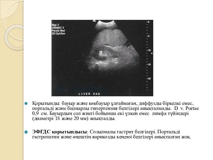 Қорытынды: бауыр және көкбауыр ұлғаймаған, диффузды біркелкі емес, портальді және билиарлы гипертензия