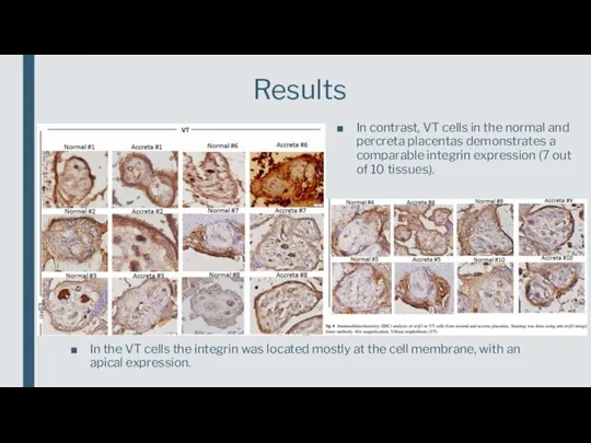 Results In contrast, VT cells in the normal and percreta placentas demonstrates
