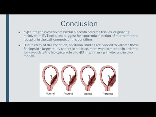 αvβ3 integrin is overexpressed in placenta percreta tissues, originating mainly from EVT