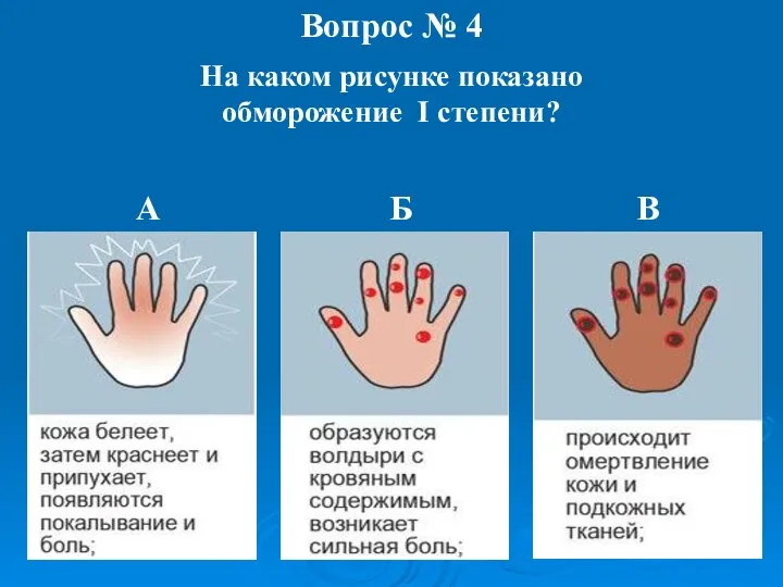 Вопрос № 4 На каком рисунке показано обморожение I степени? А Б В