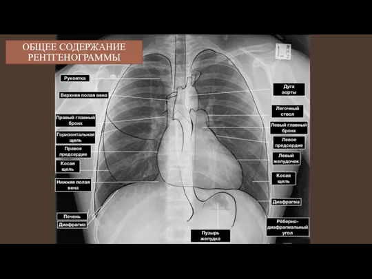 ОБЩЕЕ СОДЕРЖАНИЕ РЕНТГЕНОГРАММЫ