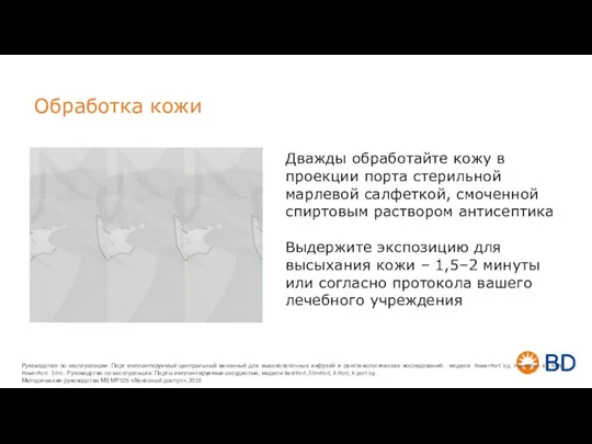 Обработка кожи Дважды обработайте кожу в проекции порта стерильной марлевой салфеткой, смоченной