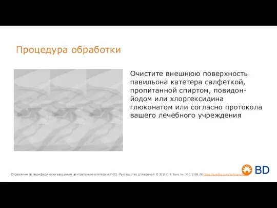 Процедура обработки Очистите внешнюю поверхность павильона катетера салфеткой, пропитанной спиртом, повидон-йодом или