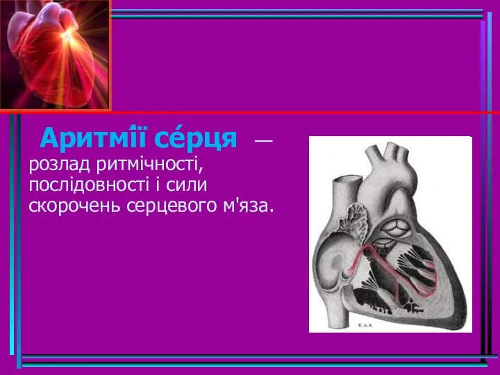 Аритмі́ї се́рця —розлад ритмічності, послідовності і сили скорочень серцевого м'яза.