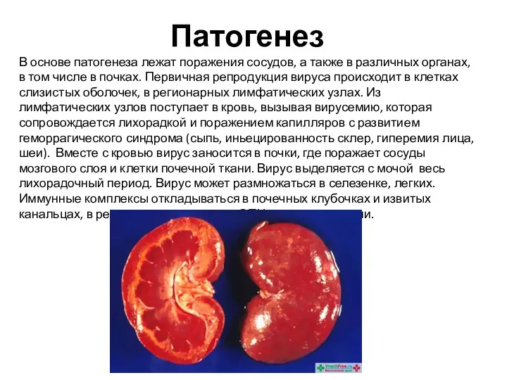 Патогенез В основе патогенеза лежат поражения сосудов, а также в различных органах,