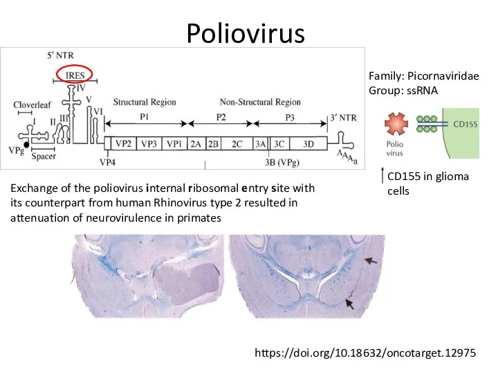 Poliovirus Family: Picornaviridae Group: ssRNA CD155 in glioma cells Exchange of the
