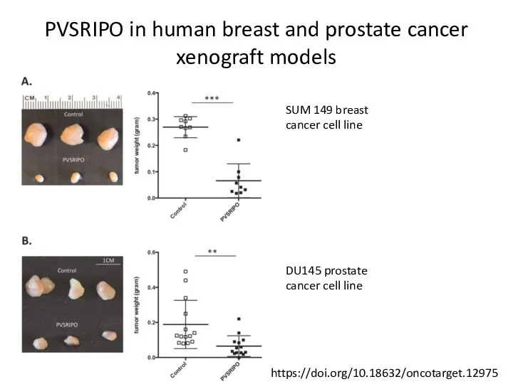 PVSRIPO in human breast and prostate cancer xenograft models SUM 149 breast