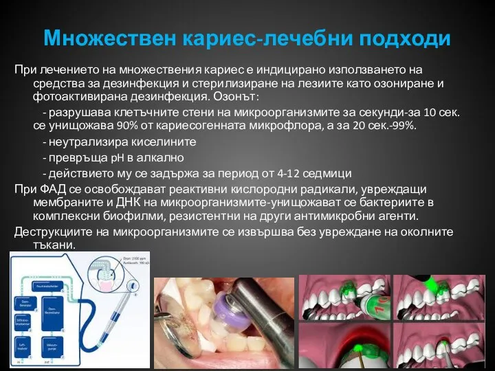 Множествен кариес-лечебни подходи При лечението на множествения кариес е индицирано използването на