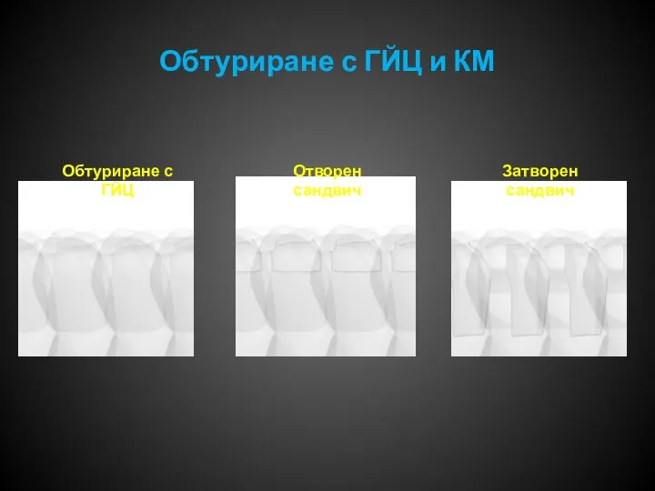 Обтуриране с ГЙЦ и КМ Затворен сандвич Отворен сандвич Обтуриране с ГЙЦ