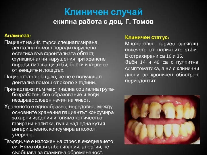 Клиничен случай екипна работа с доц. Г. Томов Анамнеза: Пациент на 24г.