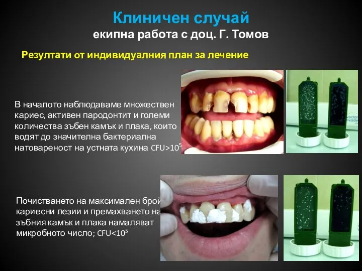 Клиничен случай екипна работа с доц. Г. Томов Резултати от индивидуалния план