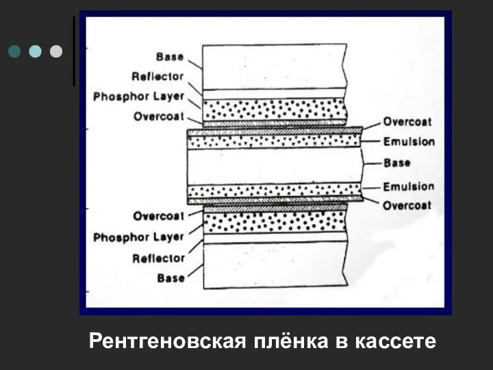 Рентгеновская плёнка в кассете