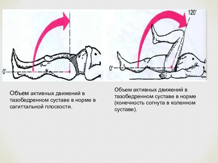 Объем активных движений в тазобедренном суставе в норме в сагиттальной плоскости. Объем