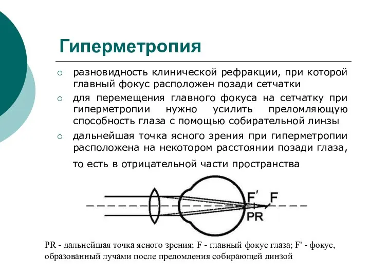 Гиперметропия разновидность клинической рефракции, при которой главный фокус расположен позади сетчатки для