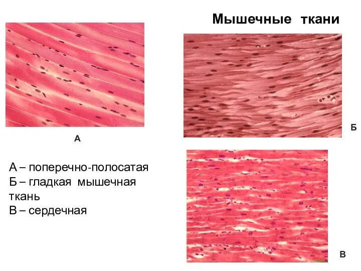 А – поперечно-полосатая Б – гладкая мышечная ткань В – сердечная А Б Мышечные ткани В
