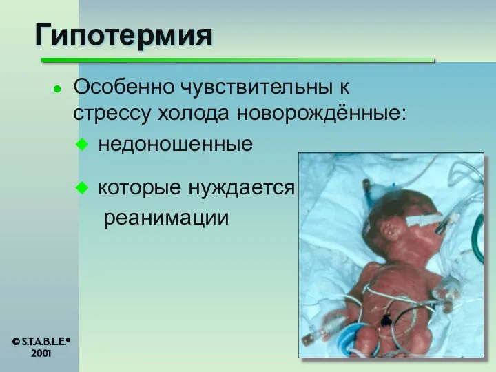 Особенно чувствительны к стрессу холода новорождённые: недоношенные которые нуждается реанимации © S.T.A.B.L.E.® 2001 Гипотермия