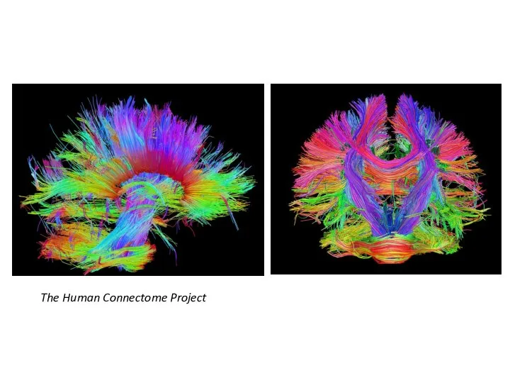 The Human Connectome Project