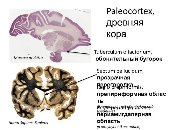 Paleocortex, древняя кора Tuberculum olfactorium, обонятельный бугорок Septum pellucidum, прозрачная перегородка Regio