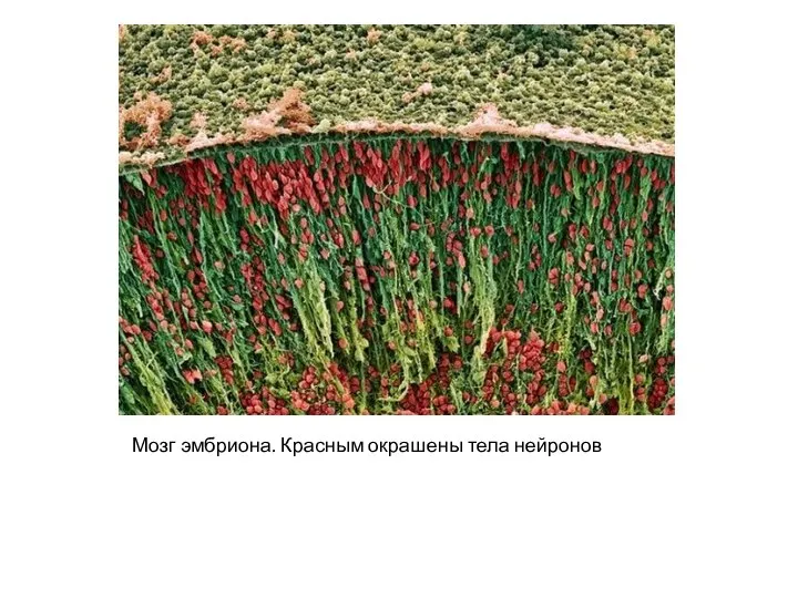 Мозг эмбриона. Красным окрашены тела нейронов
