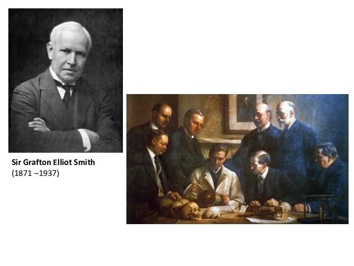 Sir Grafton Elliot Smith (1871 –1937)