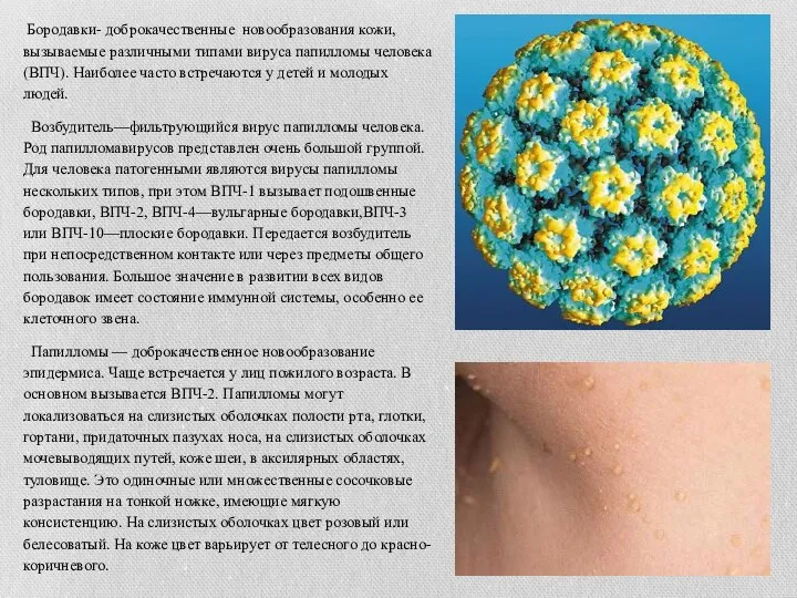 Бородавки- доброкачественные новообразования кожи, вызываемые различными типами вируса папилломы человека (ВПЧ). Наиболее