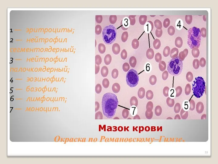 Мазок крови Окраска по Романовскому–Гимзе. 1 — эритроциты; 2 — нейтрофил сегментоядерный;