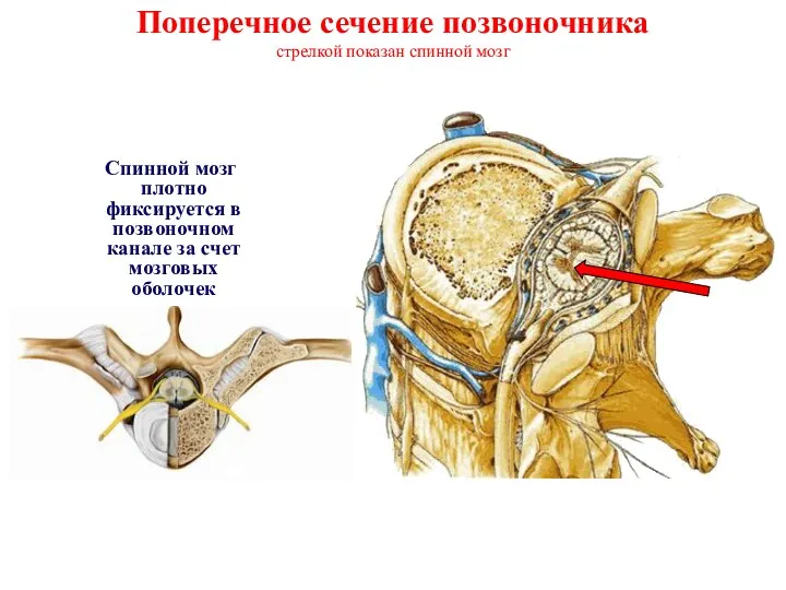 Поперечное сечение позвоночника стрелкой показан спинной мозг Спинной мозг плотно фиксируется в