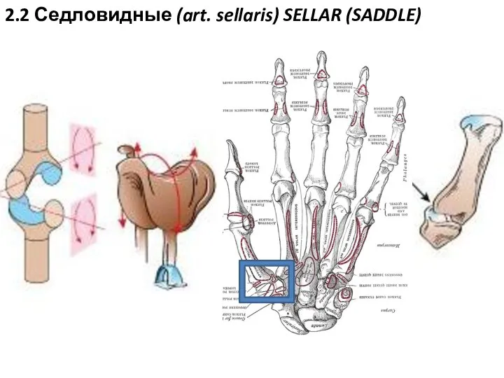 2.2 Седловидные (art. sellaris) SELLAR (SADDLE)