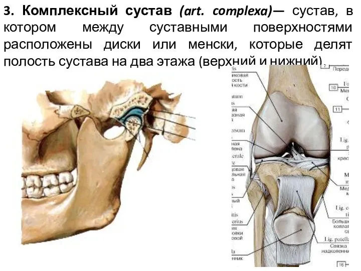 3. Комплексный сустав (art. complexa)— сустав, в котором между суставными поверхностями расположены