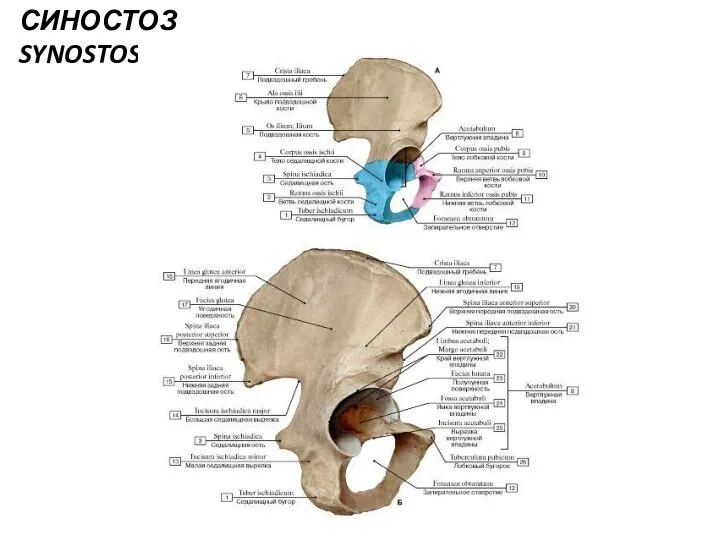 СИНОСТОЗ SYNOSTOSIS