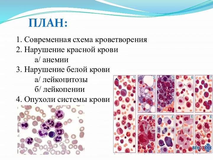 1. Современная схема кроветворения 2. Нарушение красной крови а/ анемии 3. Нарушение