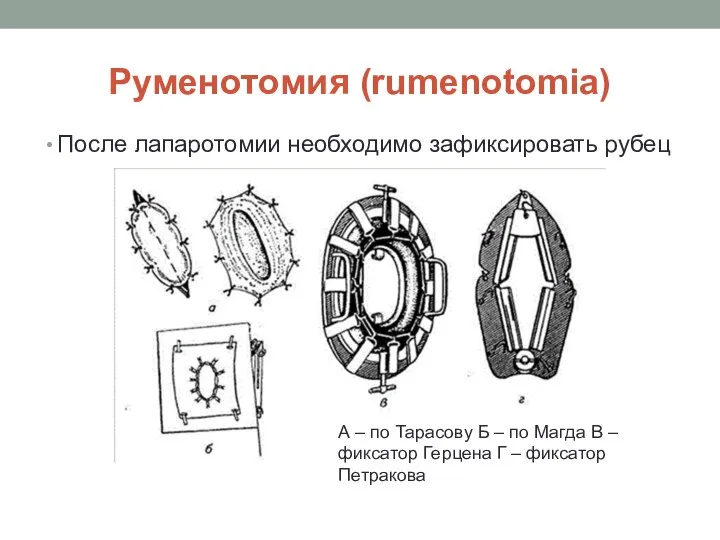 Руменотомия (rumenotomia) После лапаротомии необходимо зафиксировать рубец А – по Тарасову Б