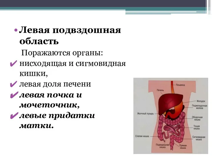 Левая подвздошная область Поражаются органы: нисходящая и сигмовидная кишки, левая доля печени