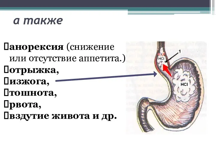 а также анорексия (снижение или отсутствие аппетита.) отрыжка, изжога, тошнота, рвота, вздутие живота и др.