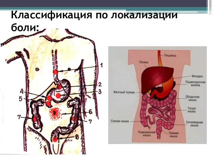 Классификация по локализации боли: