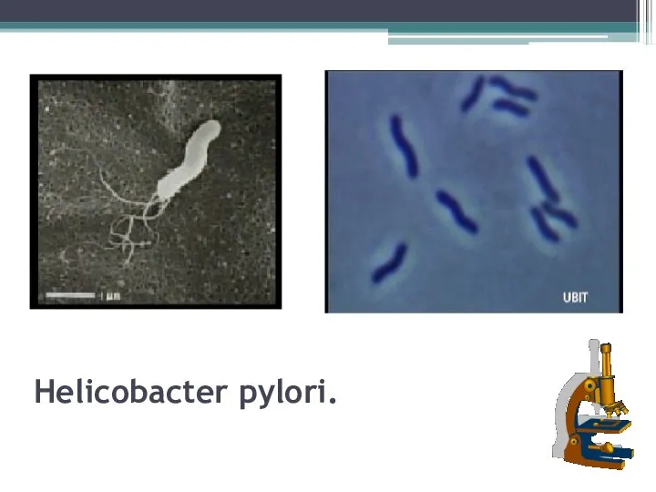 Helicobacter pylori.