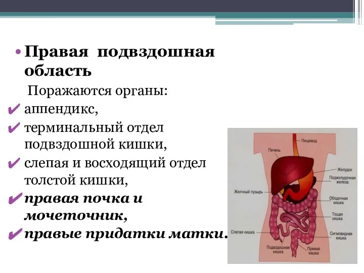 Правая подвздошная область Поражаются органы: аппендикс, терминальный отдел подвздошной кишки, слепая и