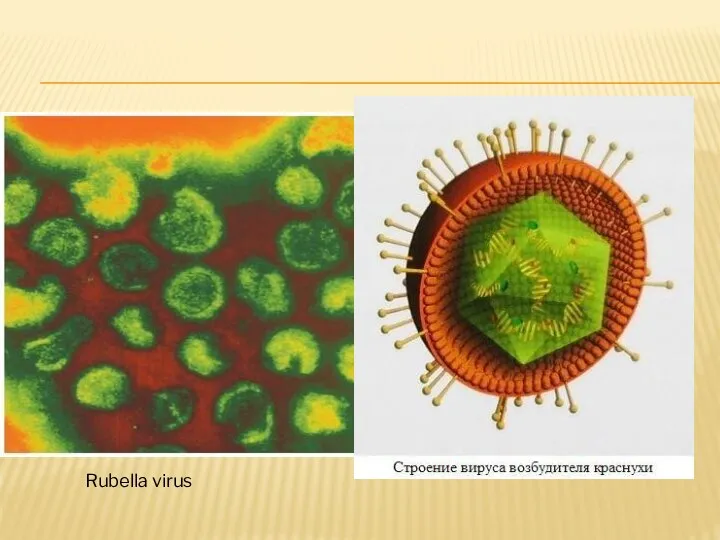 Rubella virus